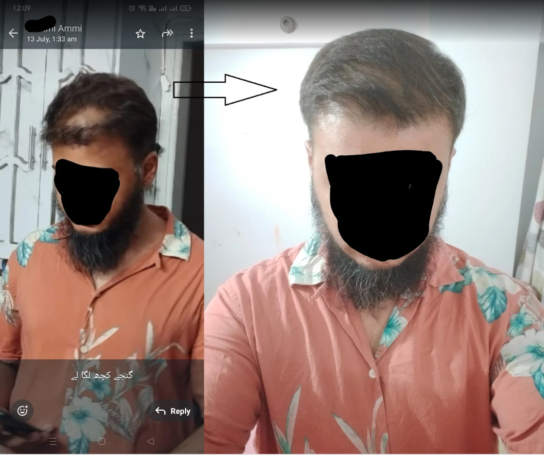 Suleman's before and after photo shared with Safa Bliss